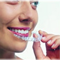 invisalign